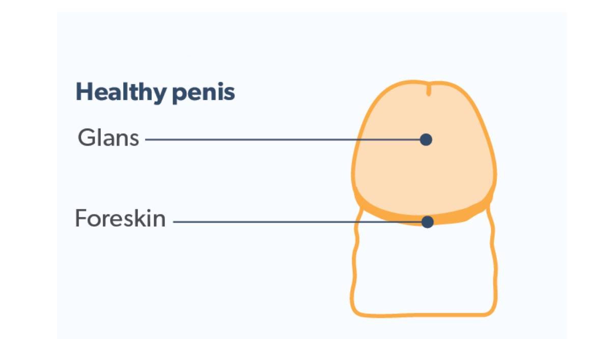 balanitis-healthy